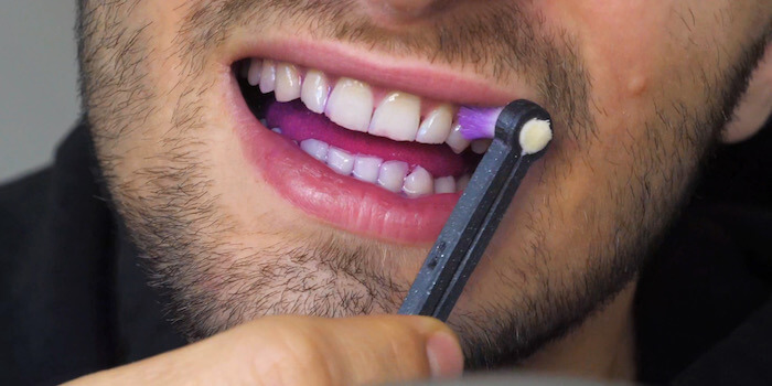 Jak si zachovat zdravé zuby